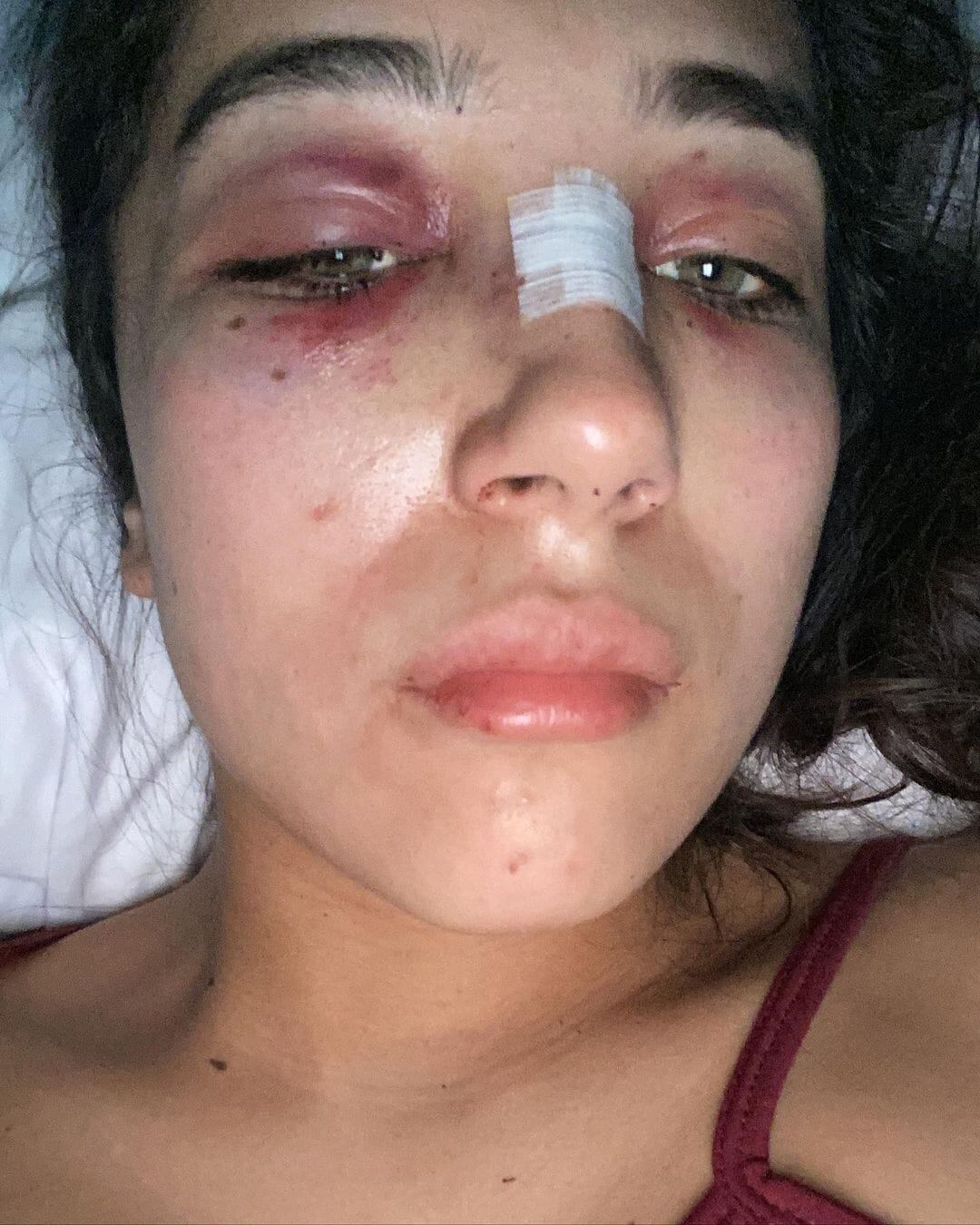 Desgarrador relato de joven maltratad y abusada por su expareja