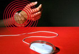 Foto: Archivo Semana. Luego de horas de trabajo frente a un computador, lo más conveniente son las pausas activas: pararse, caminar por tres minutos, estirar los miembros donde siente cansancio, flexionar las piernas, tomar agua y volver a la actividad.