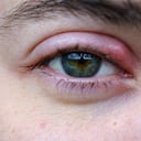 El cosmetólogo del médico comprueba la piel para la elasticidad en una barbilla doble en una niña, primer plano, cosmetología, resiliencia, problema