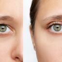 La edad es uno de los principales factores por los que ocurre este fenómeno.