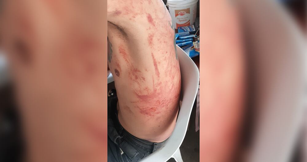 Maicol no sería la única víctima. Él asegura ser testigo de lo que pasó con otros dos hombres. Uno terminó muerto, se trata de Jesús David Hurtado. El otro, Jonatan David Velázquez, está preso, acusado, según él falsamente, por porte ilegal de armas. 