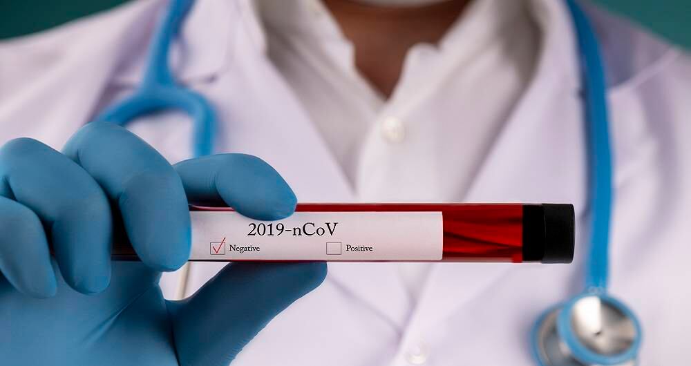 Pruebas coronavirus covid