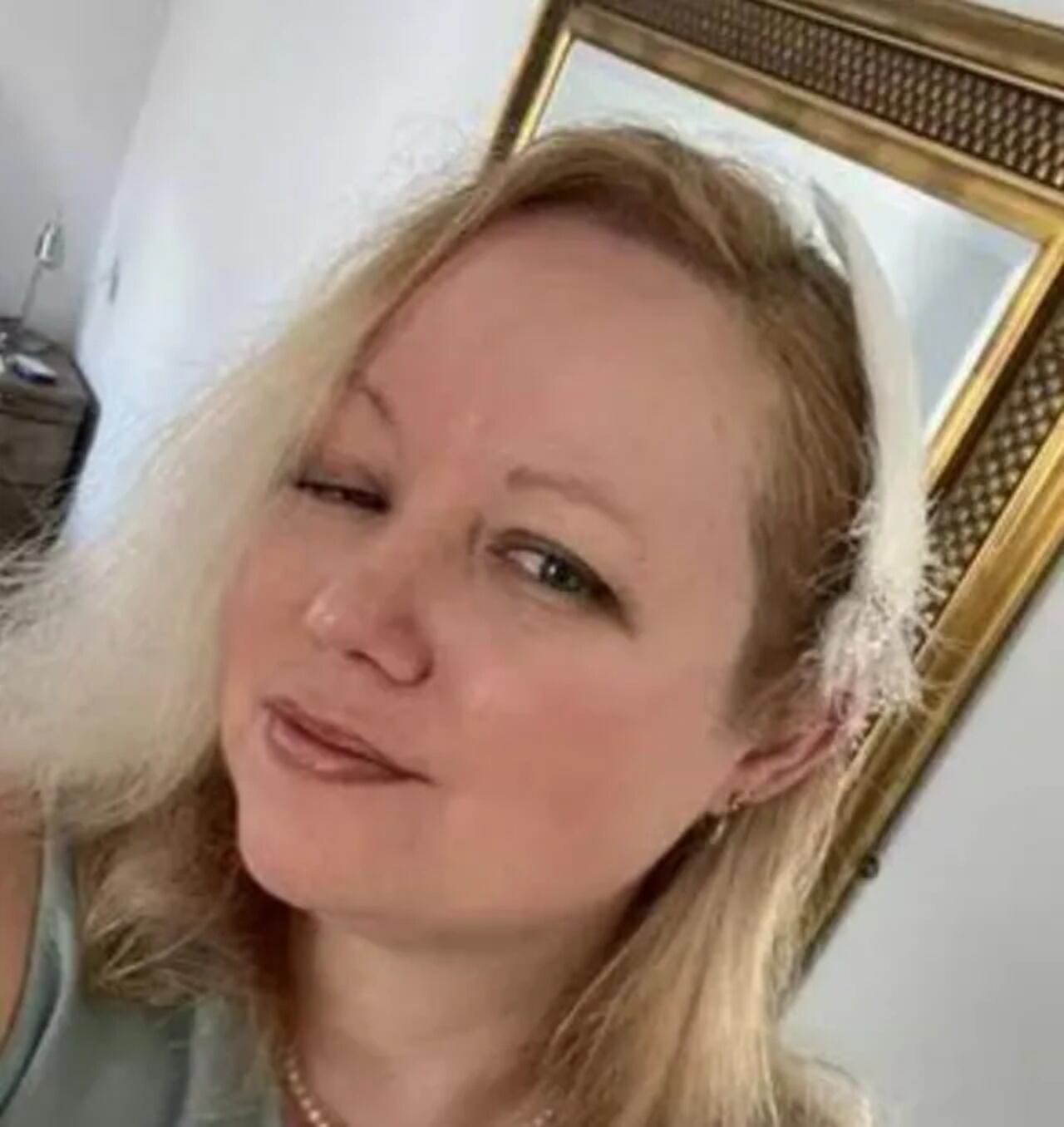 Ciaran empezó a perder la visión periférica de su ojo izquierdo.