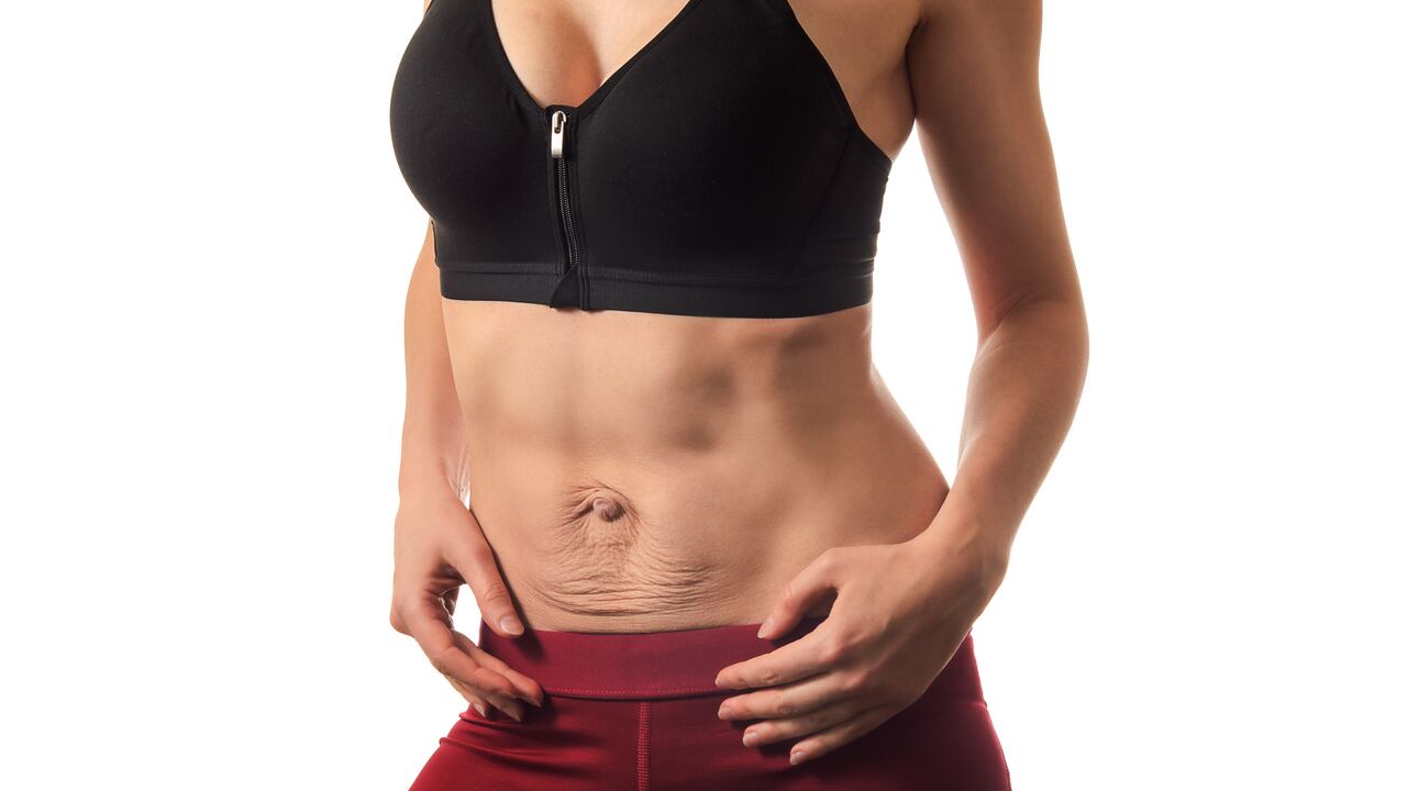 La diástasis es común en mujeres que han tenido múltiples embarazos.