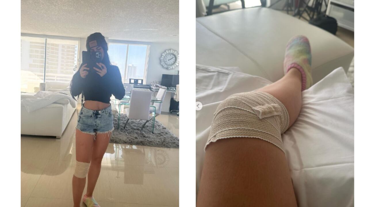 Entre lágrimas, Jessica Cediel habló sobre accidente que sufrió: "Ojalá me recupere"