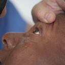 Ojos / Visión / Problemas de los ojos / Problemas de la visión / Optómetra / Oftalmólogo