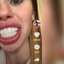 Unma mujer denuncia que después de una cirugía dental estética quedó como un caballo. Imagen de cuenta de tik tok @Lorenx