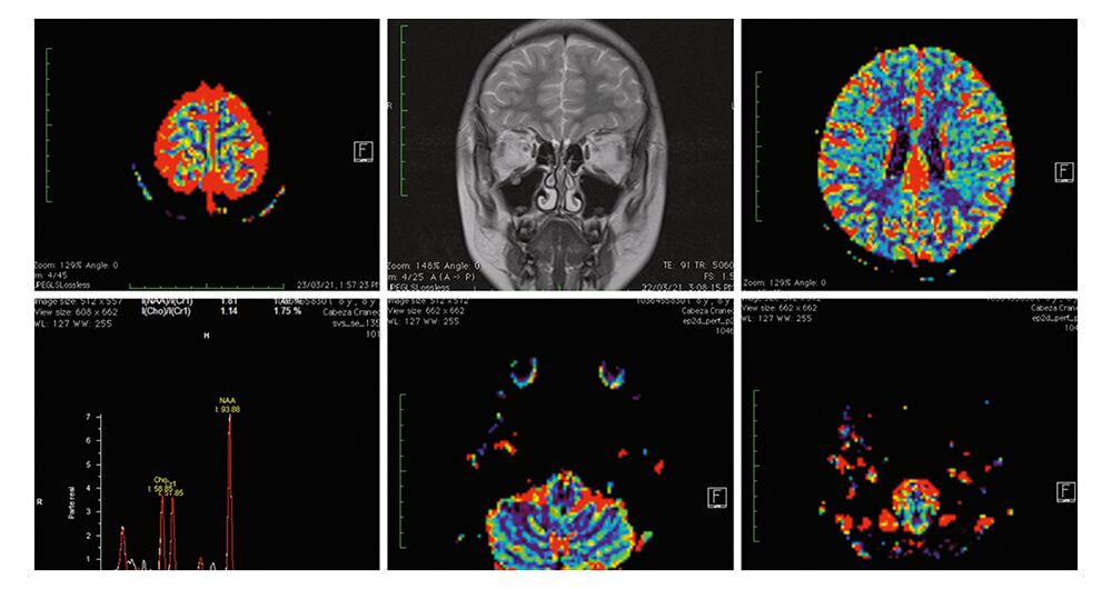  Aproximadamente, el cerebro humano tarda en procesar una imagen 13 milésimas de segundos, tiempo suficiente para que un delincuente se cohíba de cometer un crimen, aseguraron los expertos tras varios análisis realizados.    