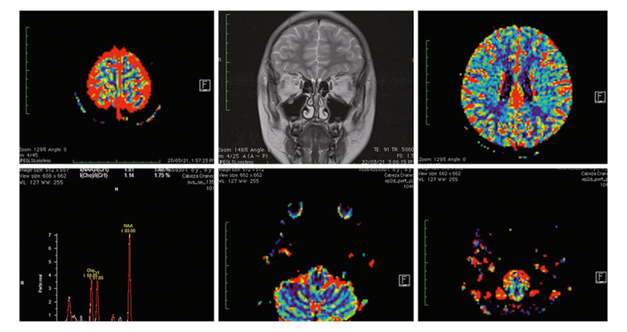 Aproximadamente, el cerebro humano tarda en procesar una imagen 13 milésimas de segundos, tiempo suficiente para que un delincuente se cohíba de cometer un crimen, aseguraron los expertos tras varios análisis realizados.