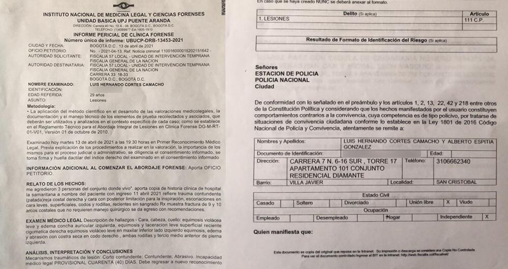 En Medicina Legal, Beto recibió incapacidad médica de 25 días tras la golpiza recibida. Por su parte, Tato fue incapacitado por 40 días.