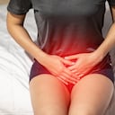 Infección urinaria y cistitis