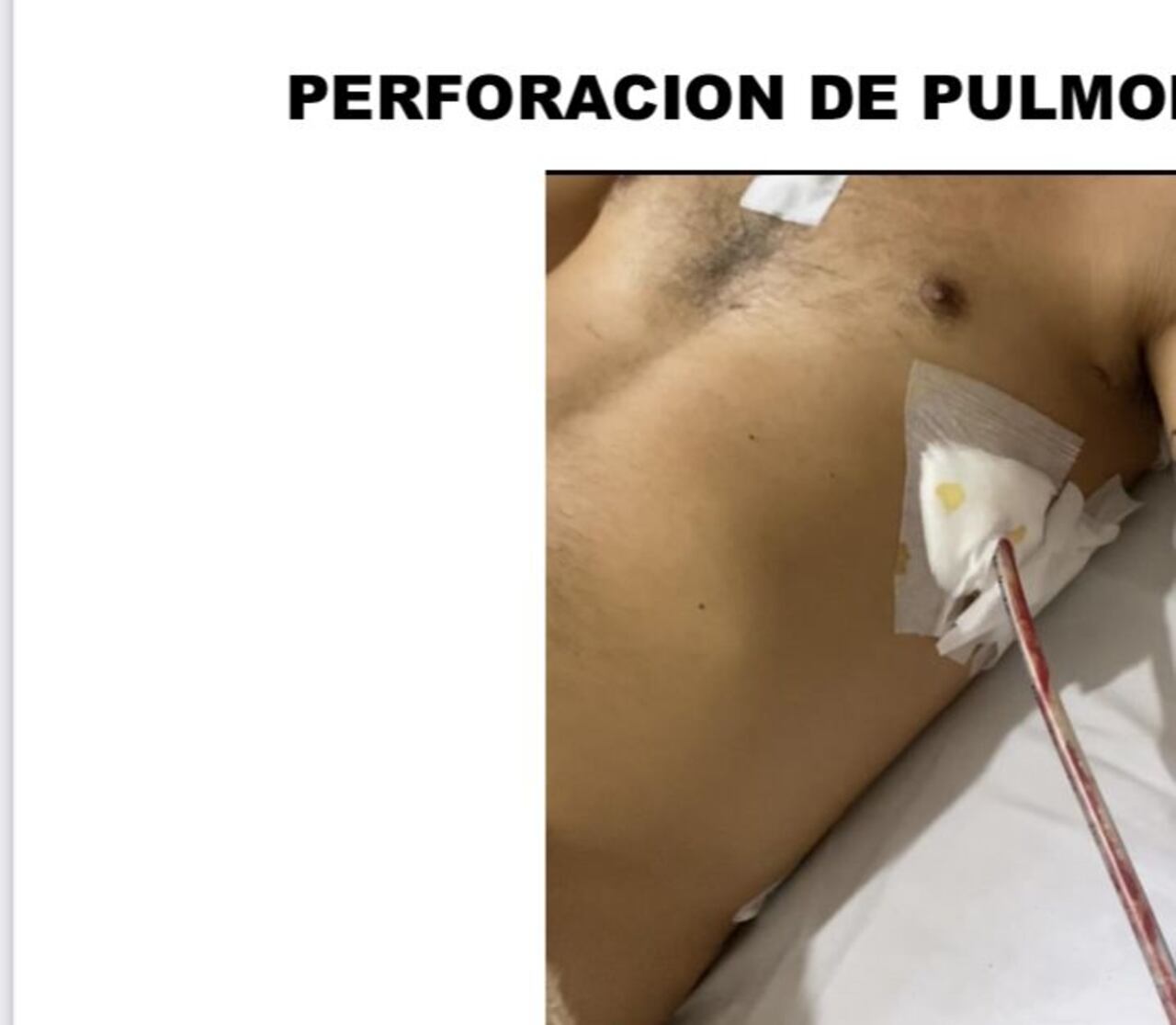 Imágenes de las heridas que sufrió Mauricio Gutiérrez.