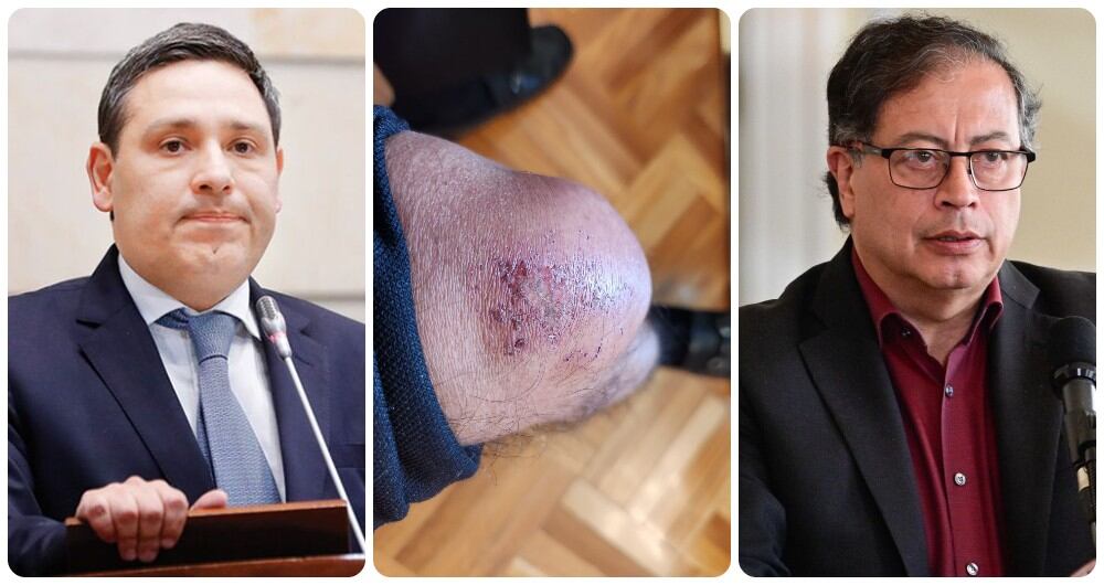 Mauricio Lizcano, Gustavo Petro y la rodilla del jefe de Estado.
