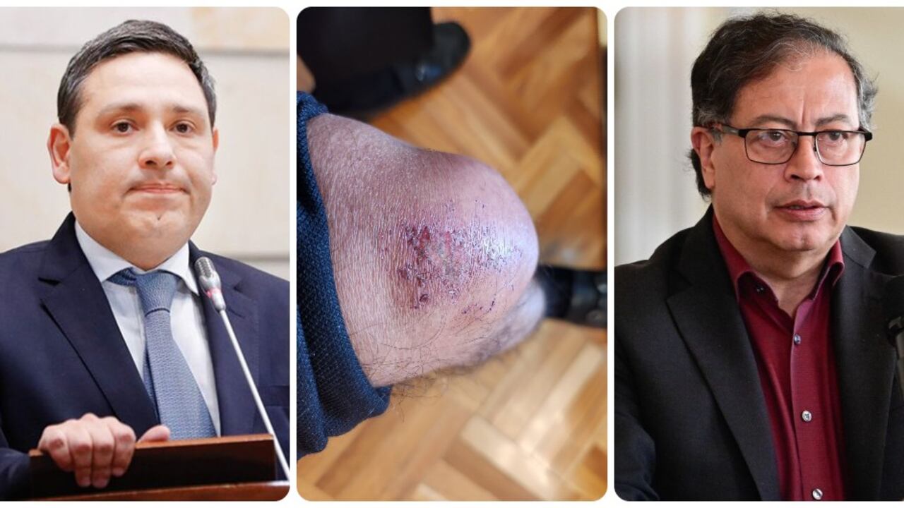 Mauricio Lizcano, Gustavo Petro y la rodilla del jefe de Estado.