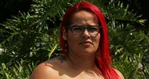 Paula Andrea Moreno Quintero se sometió a una cirugía estética en 2016 con un reconocido cirujano del país, sin embargo sufrió daños en su cuerpo.