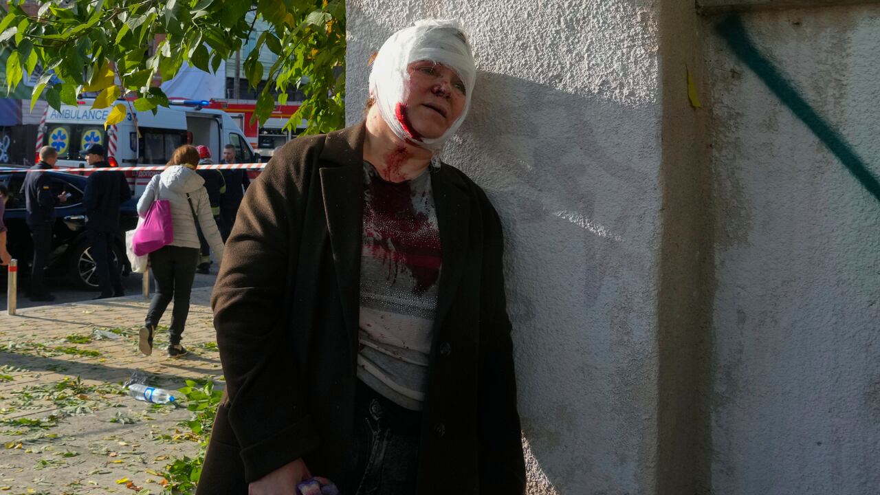 Una mujer herida reacciona tras ataques rusos en Kiev, Ucrania, el lunes 10 de octubre de 2022. Varias explosiones golpearon Kiev el lunes por la mañana tras meses de calma relativa en la capital ucraniana. (AP Foto/Efrem Lukatsky)