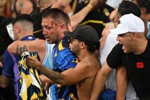 Un aficionado de argentino tiene una herida en su rostro, en medio de la trifulca que se presentó en el juego entre Brasil y Argentina, en el Maracaná, en las Eliminatorias Sudamericanas 2026. /Foto CARL DE SOUZA / AFP)