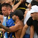Un aficionado de argentino tiene una herida en su rostro, en medio de la trifulca que se presentó en el juego entre Brasil y Argentina, en el Maracaná, en las Eliminatorias Sudamericanas 2026. /Foto CARL DE SOUZA / AFP)