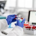 Foto de referencia sobre análisis de muestras de sangre