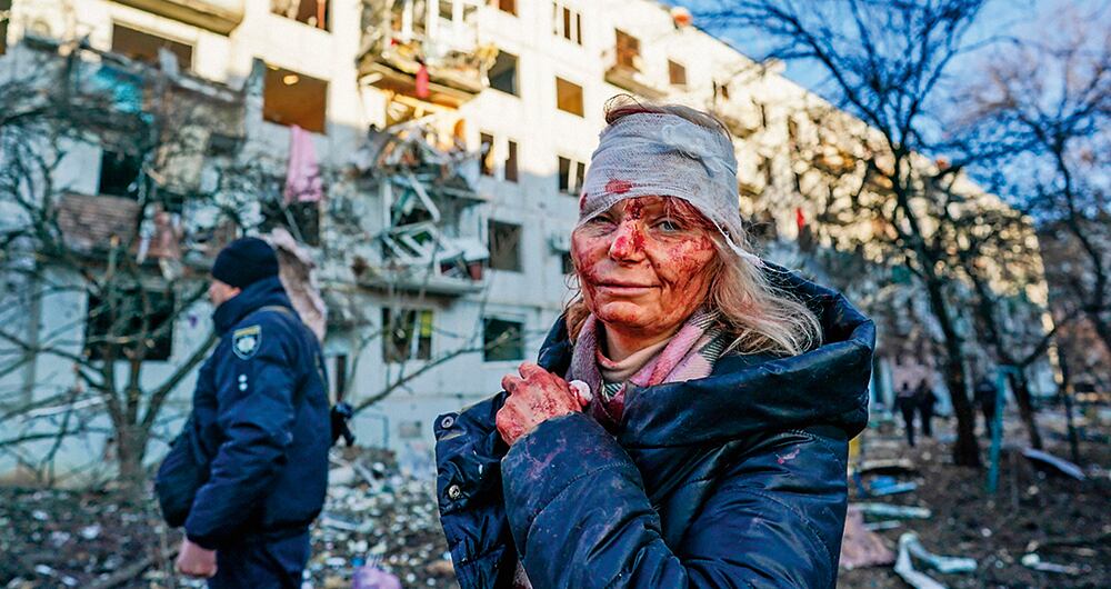 A pesar de que Rusia afirmó que su objetivo no eran los civiles, varios de estos se han visto afectados por los constantes bombardeos. 