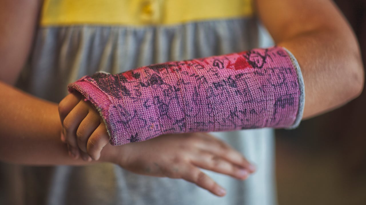 La falta de algunas vitaminas puede debilitar los huesos.