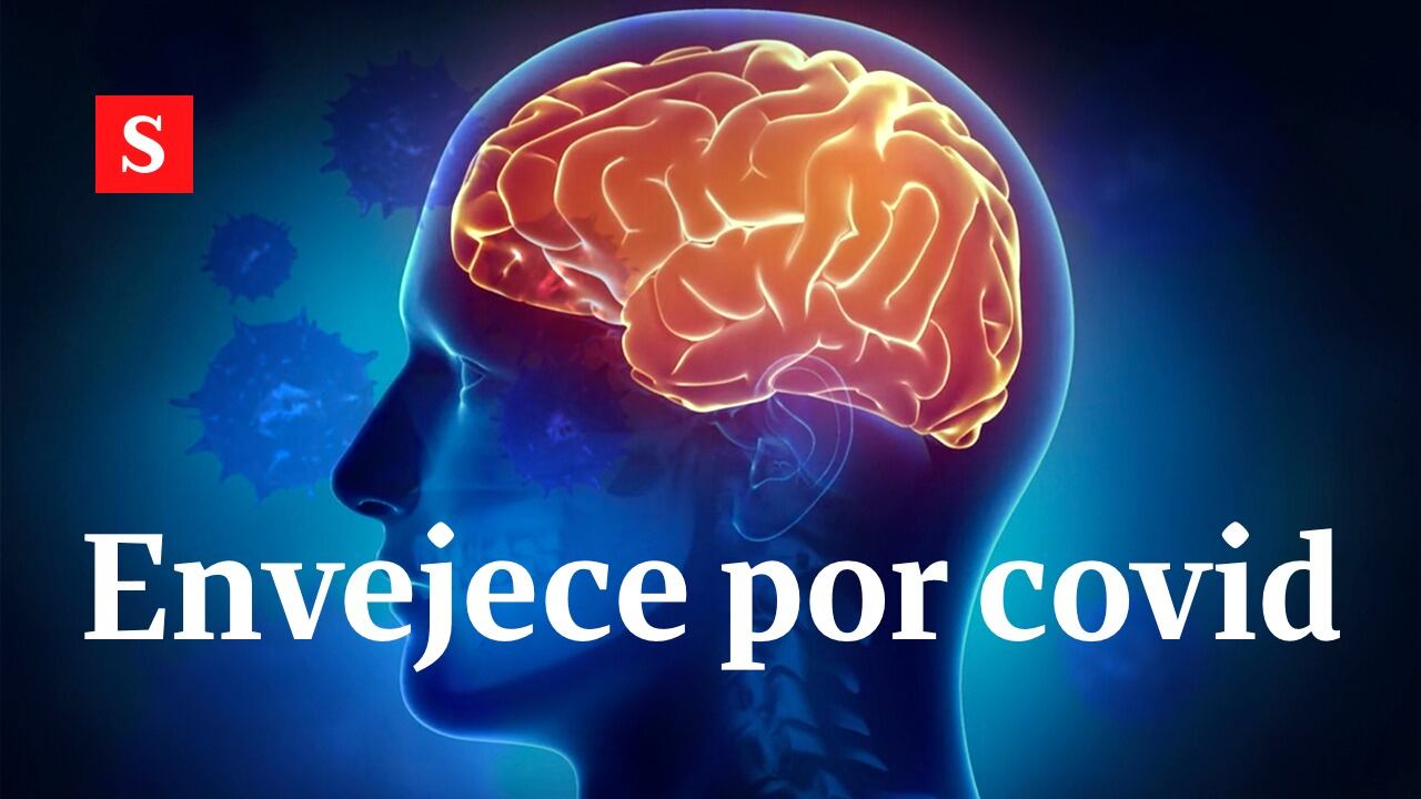CEREBRO ENVEJECE POR COVID