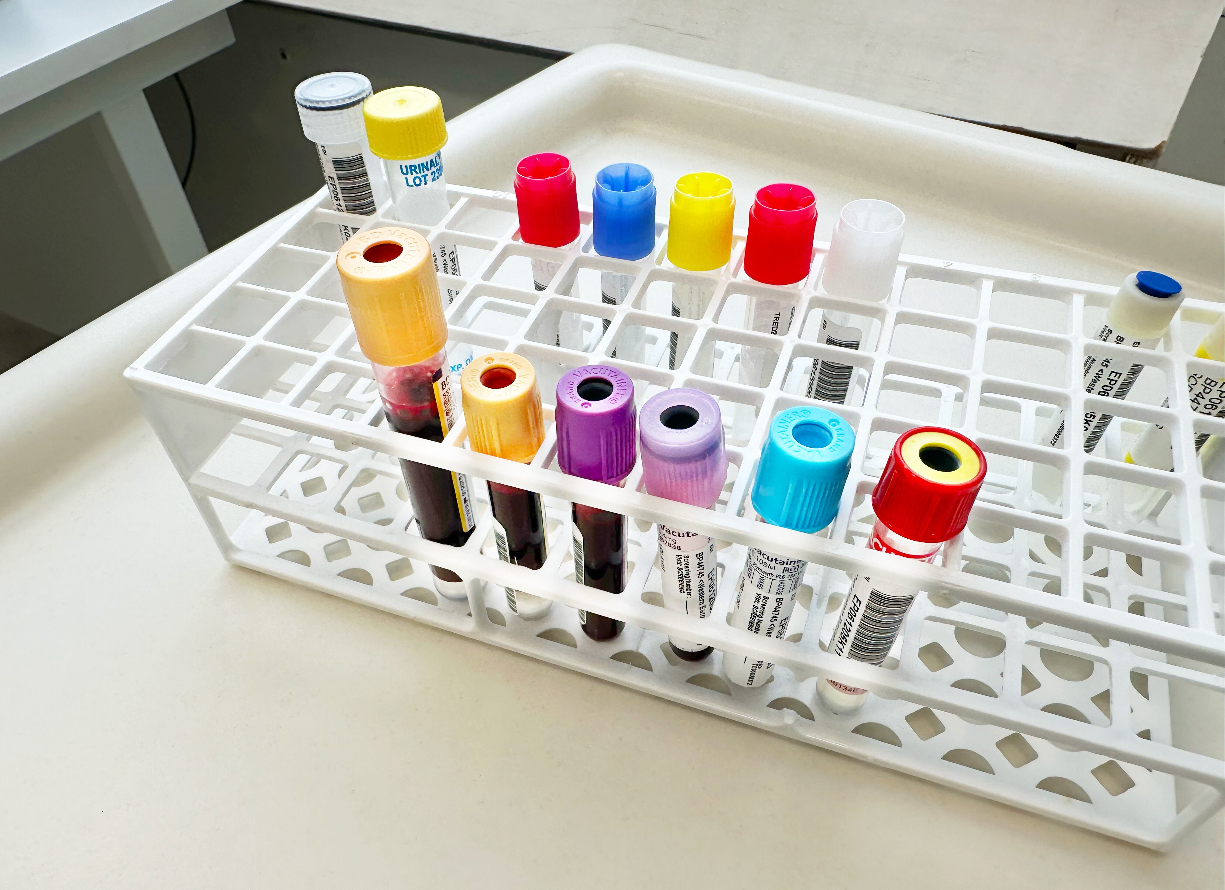 Las autoridades han recibido informes de diferentes centros médicos sobre el incremento de brotes de Norovirus