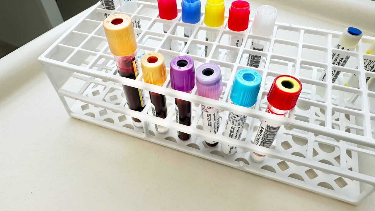 Las autoridades de Florida han registrado la muerte de cuatro personas por la infección.