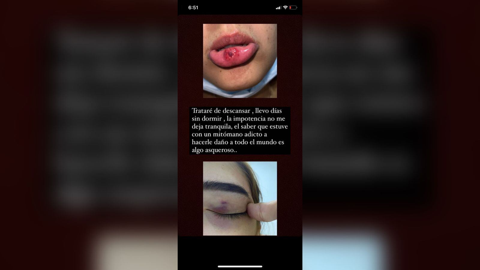 La mujer dijo que el influenciador le reventó el labio cuando le lanzó un celular.