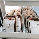 La sangre del tipo B tiene un 72 % más de posibilidades que la del tipo O de desarrollar cáncer de páncreas.