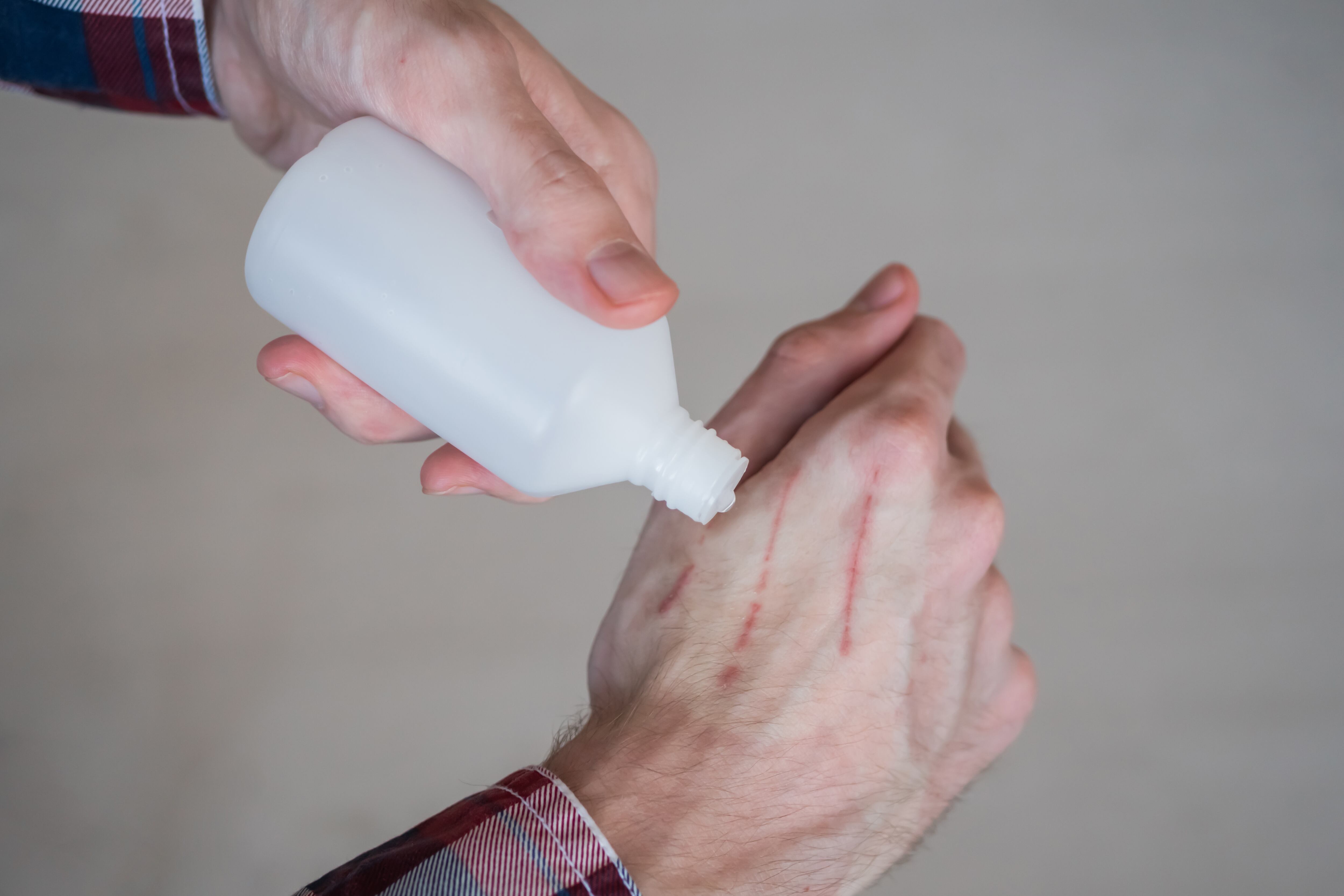 Es importante usar agua oxigenada menor del volumen 20.