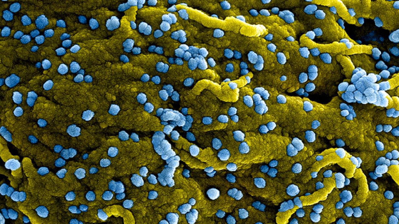La OMS había anunciado el fin del último brote de virus de Marburgo en África en 2021, sin embargo, ya se han detectado nuevos casos en Ghana.