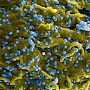 La OMS había anunciado el fin del último brote de virus de Marburgo en África en 2021, sin embargo, ya se han detectado nuevos casos en Ghana.