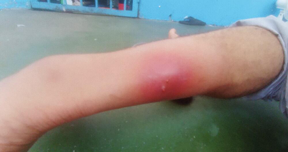 Los prisioneros se ven expuestos a toda clase de enfermedades.