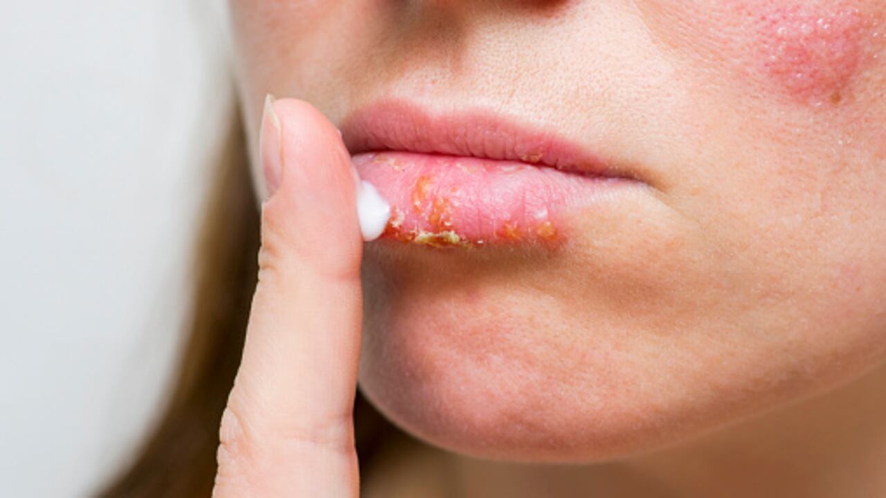 Para evitar este problema, es importante consumir abundante agua.