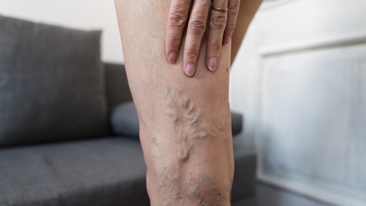 Problemas de circulación.