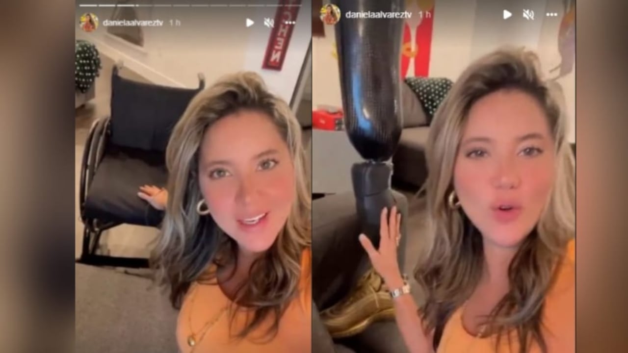 Álvarez afirmó que ya su pie había sanado, por lo que ya podía volver a utilizar su prótesis.