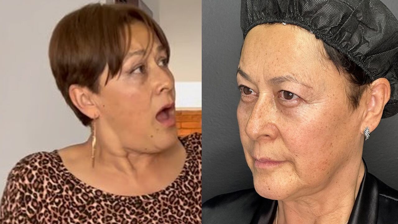 La actriz dejó ver los cambios después de sus retoques.