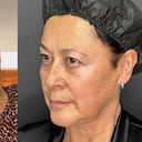 La actriz dejó ver los cambios después de sus retoques.