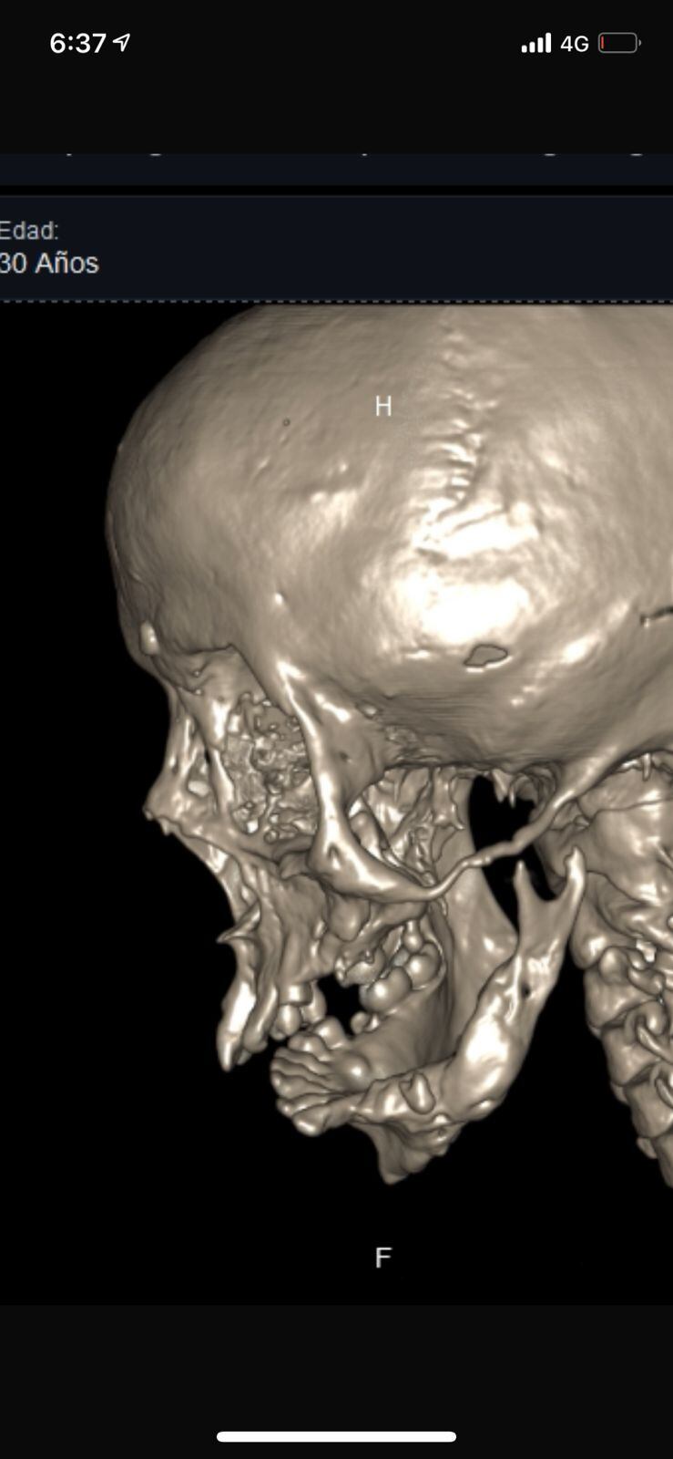 Sandra Milena Micán, la esperanza de un milagro