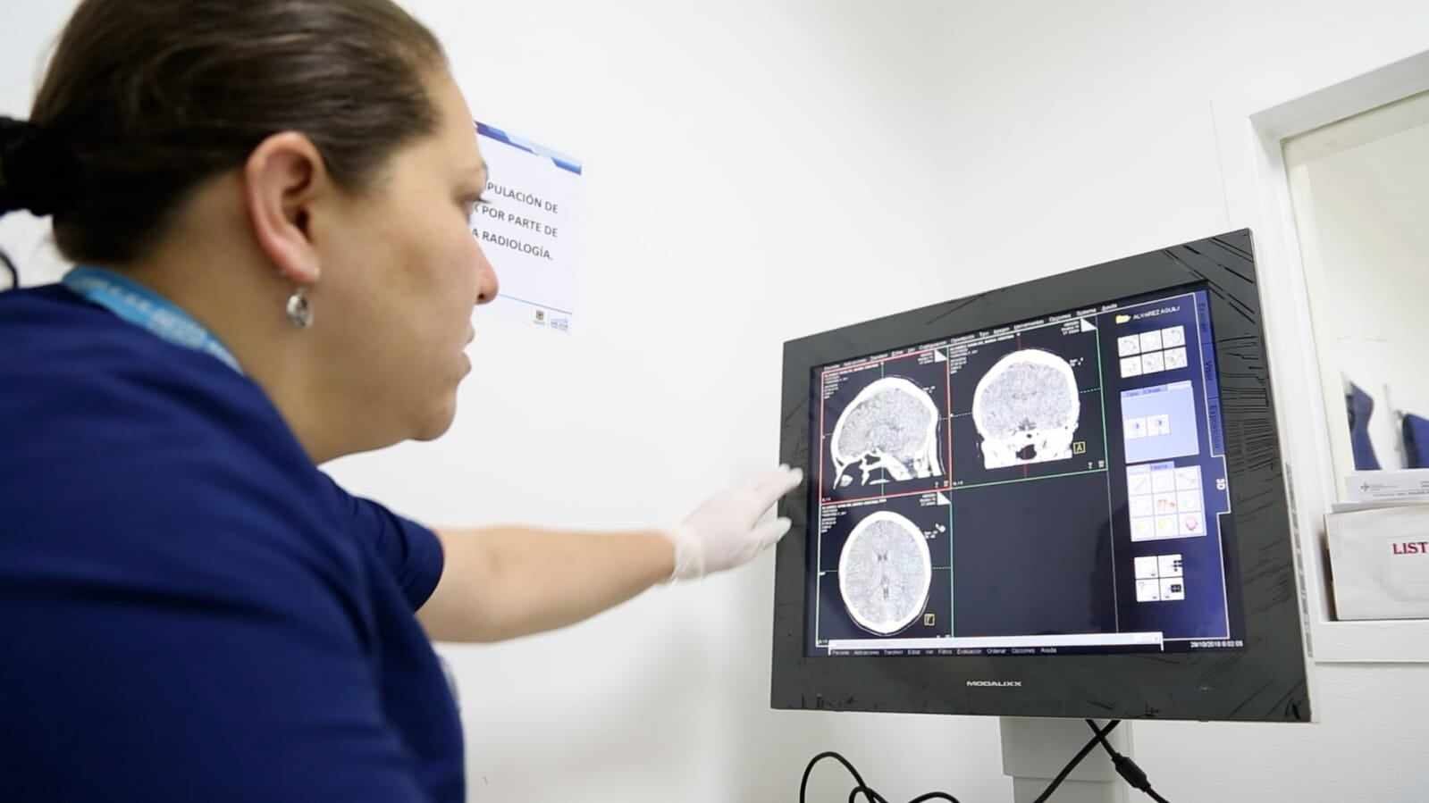 Atención para Accidentes Cerebrovasculares