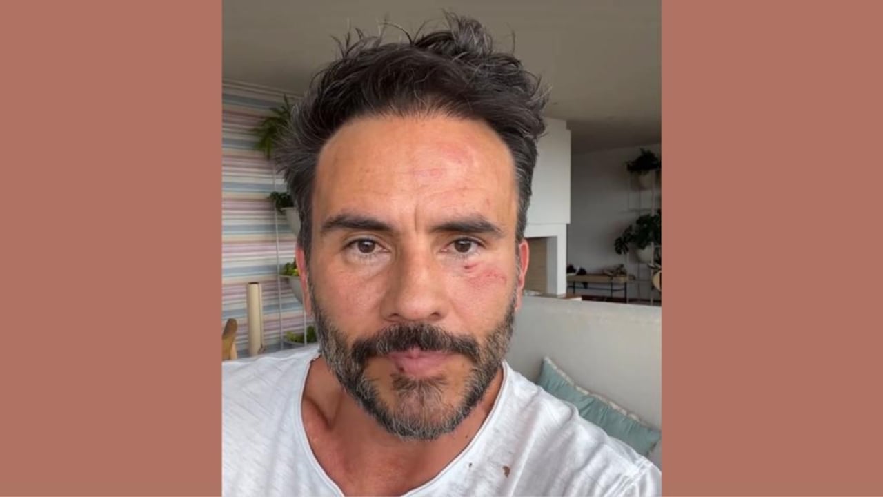 Juan Pablo Raba, actor colombiano, fue atracado y golpeado, el 6 de noviembre de 2023, en los cerros de Bogotá.