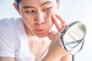 La exposición del sol puede provocar la aparición de manchas en el rostro.