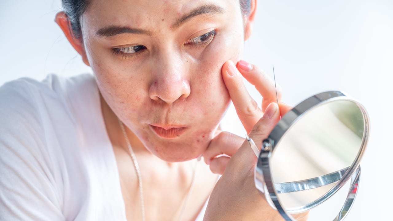 La exposición del sol puede provocar la aparición de manchas en el rostro.