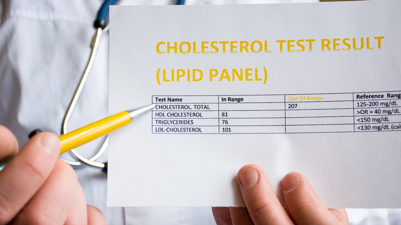Aunque el cuerpo humano necesita de colesterol, demasiada cantidad contribuye negativamente a la salud de las personas.