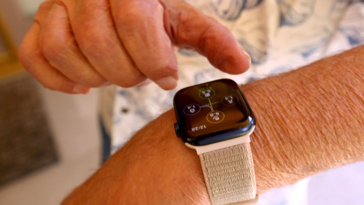 El próximo ‘smartwatch’ de Apple podrá controlar la presión arterial de los usuarios, así como detectar si padecen de la apnea del sueño.