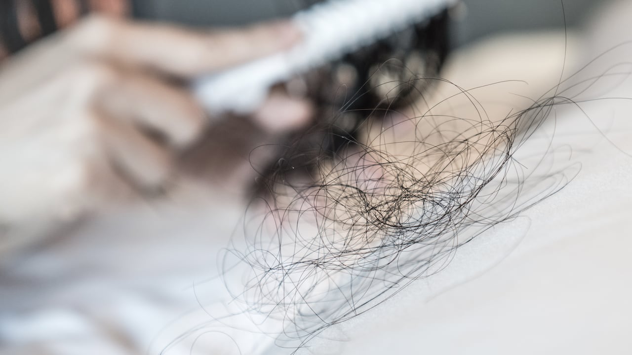 Es importante consultar con un profesional de la salud para descartar posibles enfermedades que causen la pérdida de cabello.