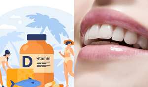 La deficiencia de vitamina D podría ocasionar problemas bucales por la falta de calcio.