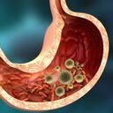 Los parásitos intestinales pueden generar síntomas como diarrea, estreñimiento y cambio de color en las heces.