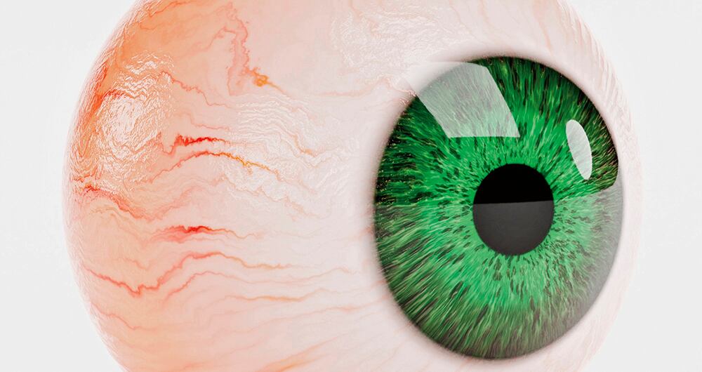 Menos carne, menos síntomas_3